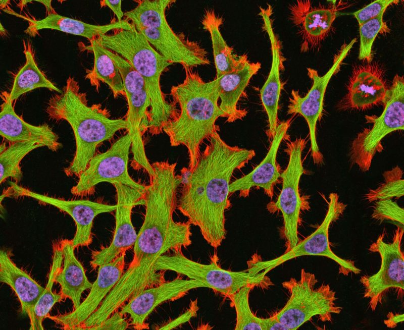 Cells: Chloroplast, Organism, Animal Cell thumbnail